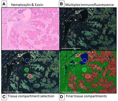 Frontiers  Multiplex Immunofluorescence and the Digital Image Analysis  Workflow for Evaluation of the Tumor Immune Environment in Translational  Research