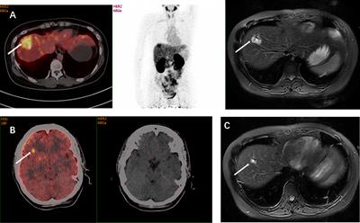 Noninvasive assessment of characteristics of novel anti-HER2