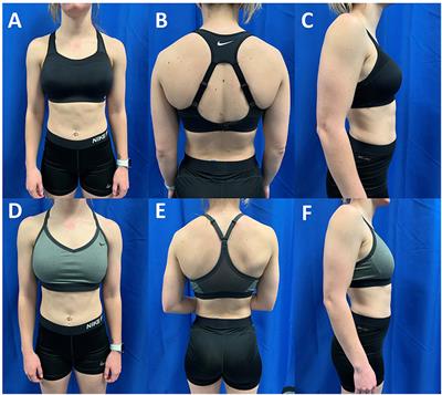 Wearing right sports bra increases women's running performance, study  suggests