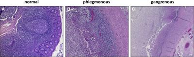 Frontiers | A concise pathophysiological model of acute appendicitis ...