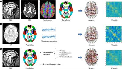 Frontiers  Morphometric and Functional Brain Connectivity