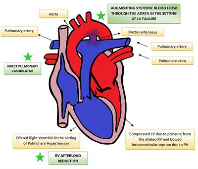 Frontiers | Use of Prostaglandin E1 in the Management of Congenital ...