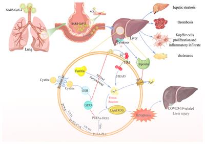 Frontiers | Ferroptosis in COVID-19-related liver injury: A potential ...