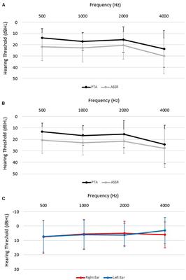 PDF) [Auditory steady-state response in the auditory evaluation: clinical  application]