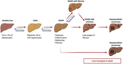 Frontiers | Association between serum ferritin level and the various ...