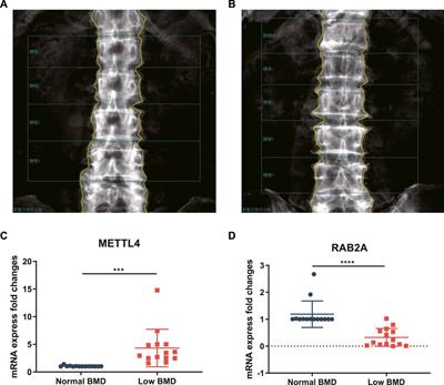 Bone Density Evaluation (DEXA) - Patient Services - Assured Imaging