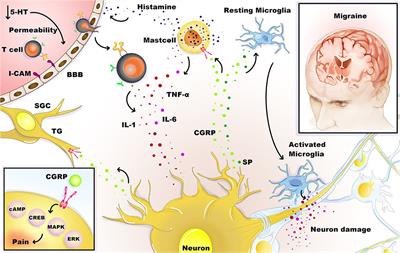 Frontiers | Immunologic aspects of migraine: A review of literature