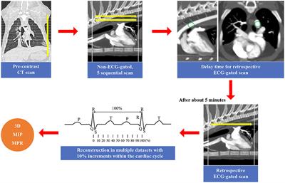 Frontiers | Non-electrocardiography- and electrocardiography-gated ...