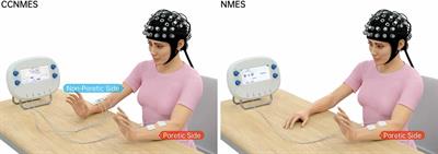 Neuromuscular electrical stimulation – Is it useful for training, recovery,  and rehab?