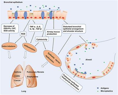 Frontiers | Microplastics, potential threat to patients with lung diseases