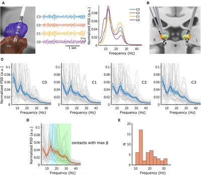 Frontiers | Subthalamic high-beta oscillation informs the outcome of ...