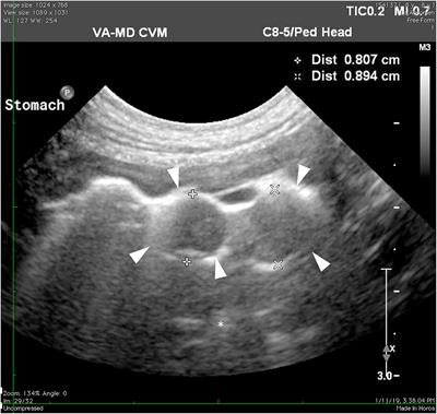 Frontiers | Ultrasonographic and endoscopic guidance in diagnosis of ...