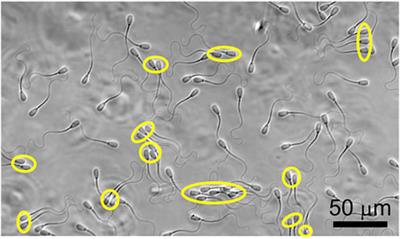 Biological benefits of collective swimming of sperm in a viscoelastic fluid