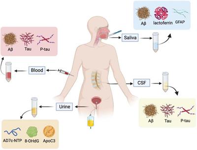 Frontiers Is liquid biopsy mature enough for the diagnosis of Alzheimers disease? pic