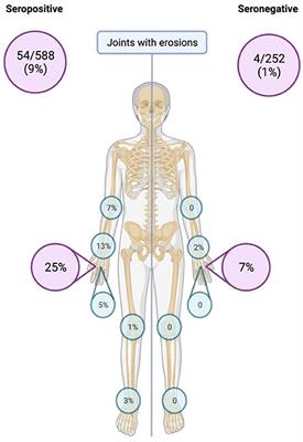 Frontiers | Patients with seronegative rheumatoid arthritis have a ...