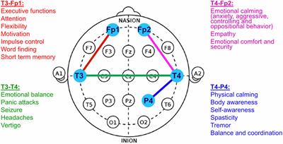 Is Neurofeedback-based Brain training the same as electroshock therapy?” -  ECT