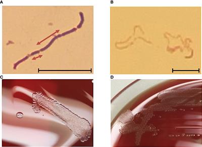 Frontiers | Human Erysipelothrix rhusiopathiae infection via bath water ...