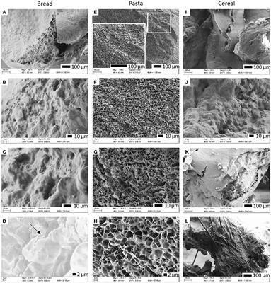 Frontiers | Digestion of protein and toxic gluten peptides in wheat ...