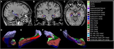 Frontiers | Hippocampal adaptation to high altitude: a neuroanatomic ...