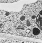 Plant Organelle Interaction Network and Membrane Contact Sites ...