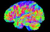 Advanced Diffusion MRI for Brain Microstructure: Methodology ...