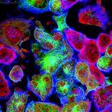 Cell Death in Cancer Immunology | Frontiers Research Topic