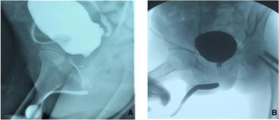 Frontiers  Case report: A preterm infant with rubinstein-taybi