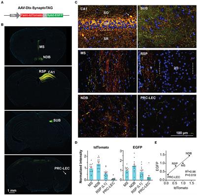 Frontiers  Lasting mesothalamic dopamine imbalance and altered