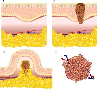 Frontiers | Invasive and non-invasive electrodes for successful drug ...