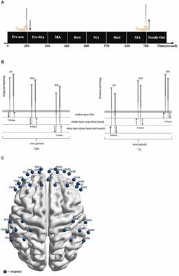 Frontiers  Tele-supervised home-based transcranial alternating current  stimulation (tACS) for Alzheimer's disease: a pilot study