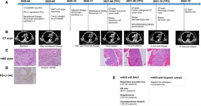 Frontiers  Syrian hamster as an ideal animal model for evaluation of  cancer immunotherapy