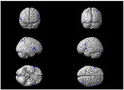 right inferior frontal gyrus - List of Frontiers' open access articles