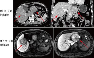 Frontiers  A Scientometric Analysis and Visualization Discovery of  Enhanced Recovery After Surgery