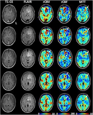 Frontiers | Transient deoxyhemoglobin formation as a contrast for ...