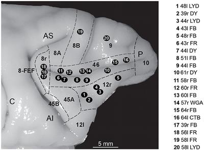 Frontiers  Lasting mesothalamic dopamine imbalance and altered