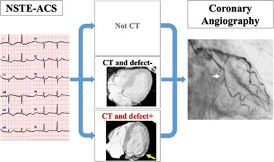 Frontiers  Association of Lipoprotein(a)-Associated Mortality and the  Estimated Glomerular Filtration Rate Level in Patients Undergoing Coronary  Angiography: A 51,500 Cohort Study