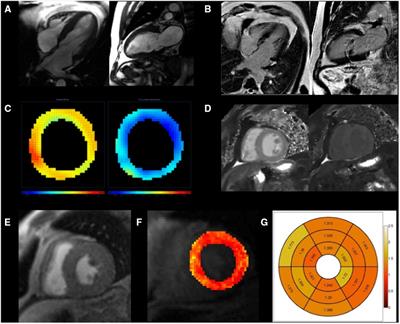 Frontiers | Cardiometabolic biomarker patterns associated with cardiac ...