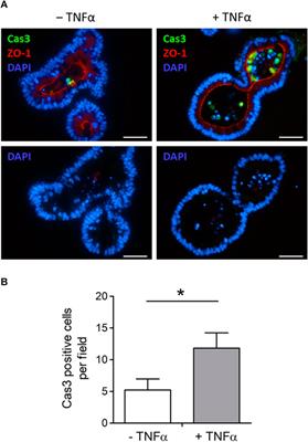 Frontiers | Time-dependent effects of tumor necrosis factor α on Ca2 ...