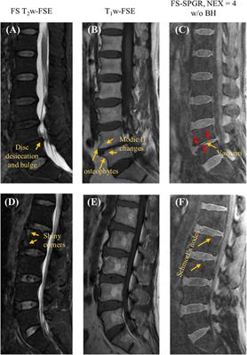 Frontiers | Evaluation of spine disorders using high contrast imaging ...