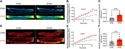 CaMKIIδ-dependent dysregulation of atrial Na+ homeostasis promotes pro-arrhythmic activity in an obstructive sleep apnea mouse model