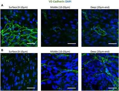 Localization of Engineered Vasculature within 3D Tissue Constructs