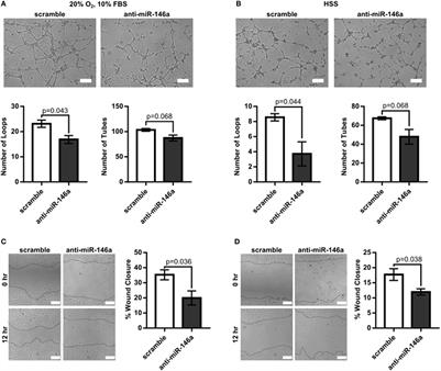 MicroRNA-146a Regulates Perfusion Recovery in Response to Arterial Occlusion via Arteriogenesis