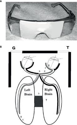 photobiomodulation depression