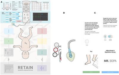 Neonatal Resuscitation Program List Of Frontiers Open Access Articles