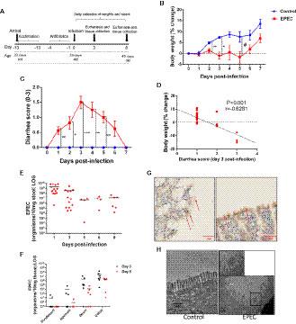 Enteropathogenic Escherichia coli Infection Induces Diarrhea, Intestinal Damage, Metabolic Alterations, and Increased Intestinal Permeability in a Murine Model