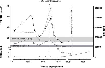 Frontiers  Emerging Progress in Nausea and Vomiting of Pregnancy and  Hyperemesis Gravidarum: Challenges and Opportunities