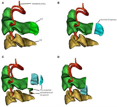 Frontiers  Common Patterns of Skull Bone Fusion and Their Potential to  Discriminate Different Ontogenetic Stages in Extant Birds