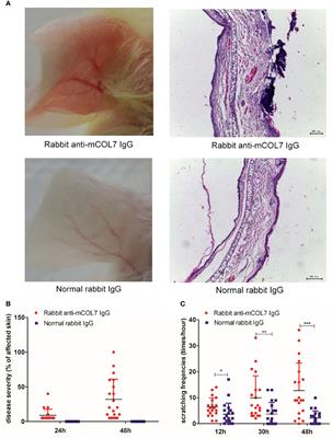 Frontiers  Epidermolysis Bullosa Acquisita: The 2019 Update