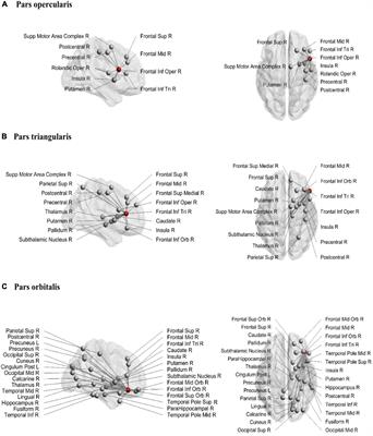Frontiers  Differential responses from the left postcentral gyrus, right  middle frontal gyrus, and precuneus to meal ingestion in patients with  functional dyspepsia