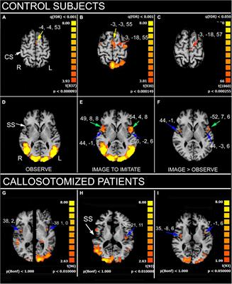 Frontiers  Age-Related Variations in Regional White Matter Volumetry and  Microstructure During the Post-adolescence Period: A Cross-Sectional Study  of a Cohort of 1,713 University Students